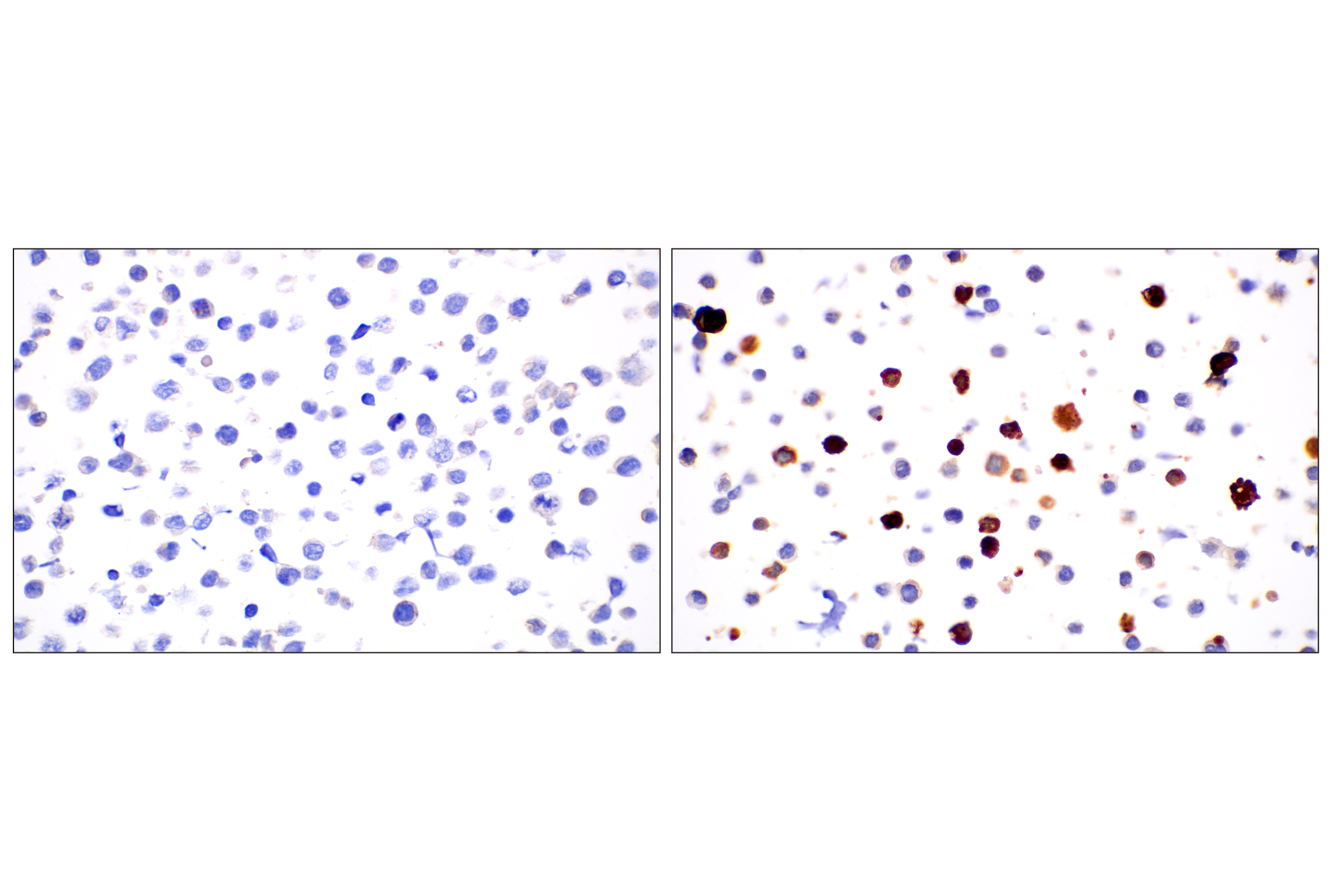 Immunohistochemistry Image 8: PNPLA3 (E7N6O) Rabbit mAb (BSA and Azide Free)