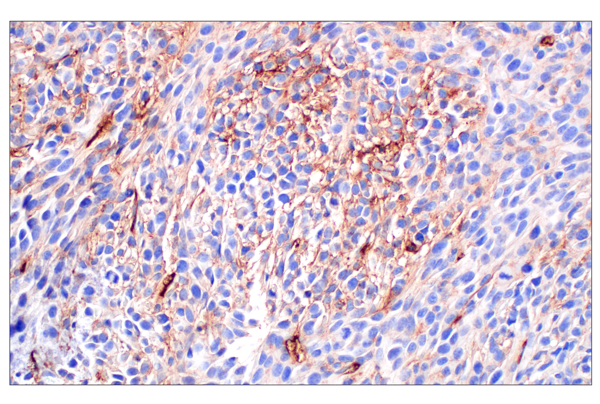 Immunohistochemistry Image 6: PNPLA3 (E7N6O) Rabbit mAb (BSA and Azide Free)