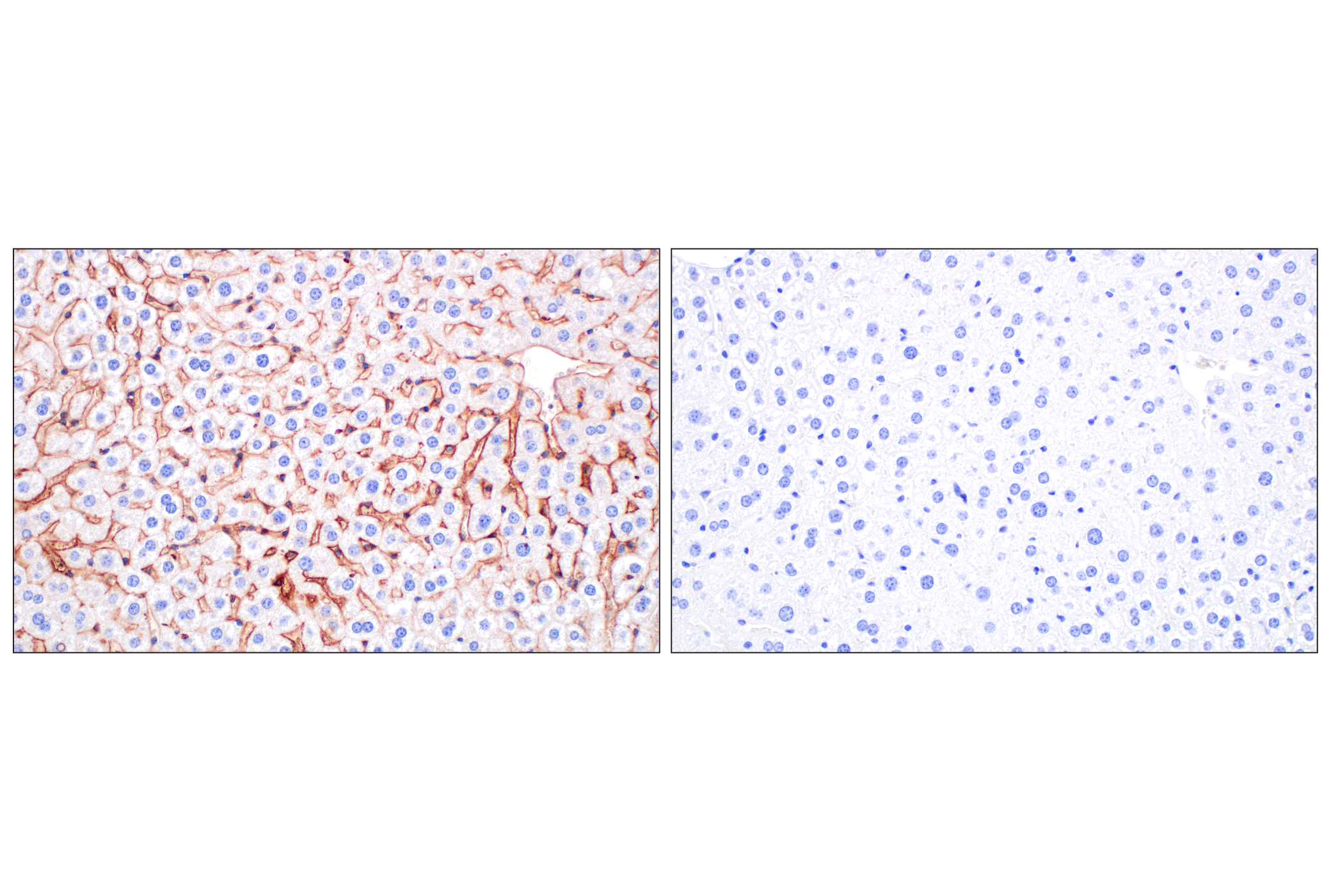 Immunohistochemistry Image 7: PNPLA3 (E7N6O) Rabbit mAb (BSA and Azide Free)