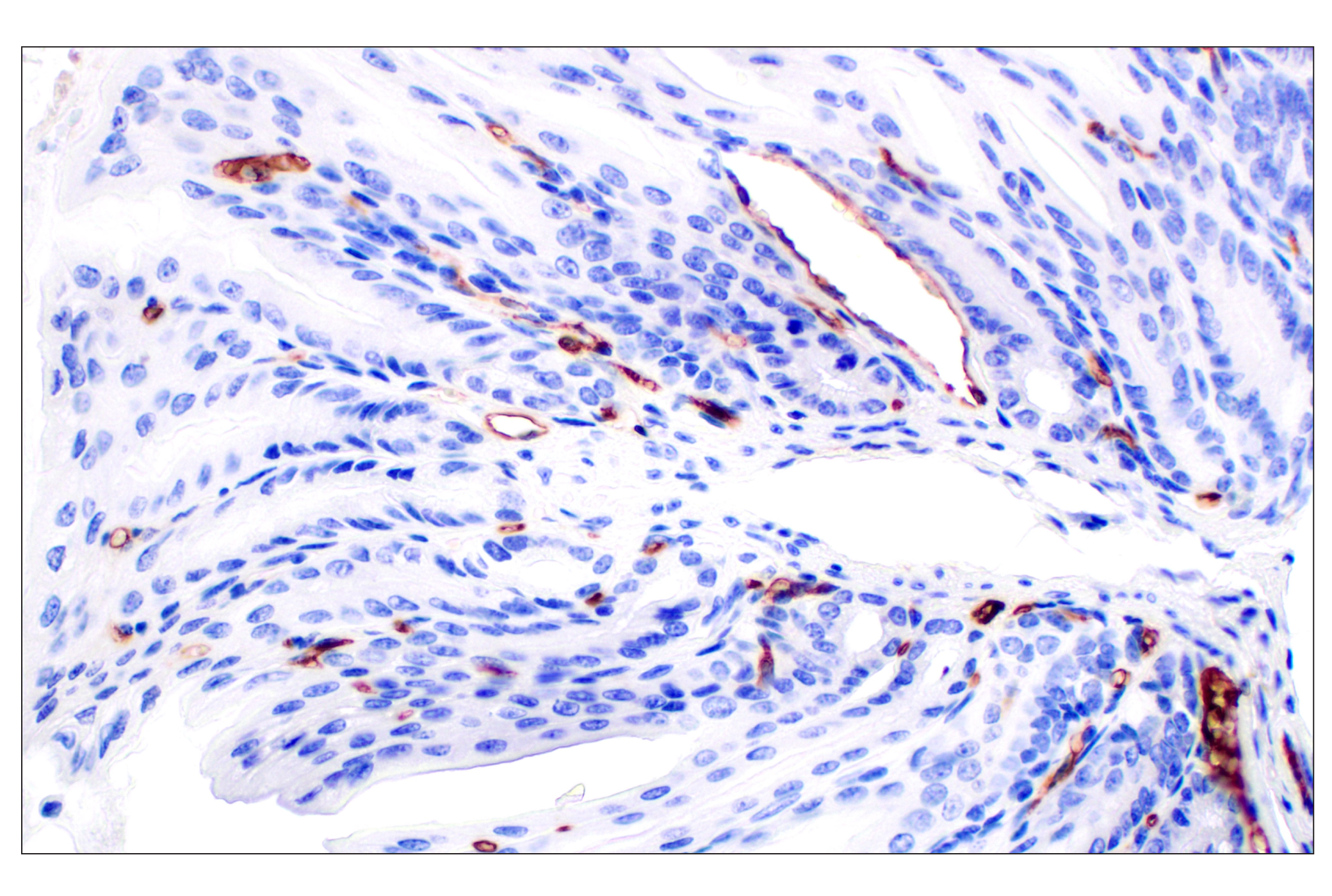 Immunohistochemistry Image 1: PNPLA3 (E7N6O) Rabbit mAb (BSA and Azide Free)