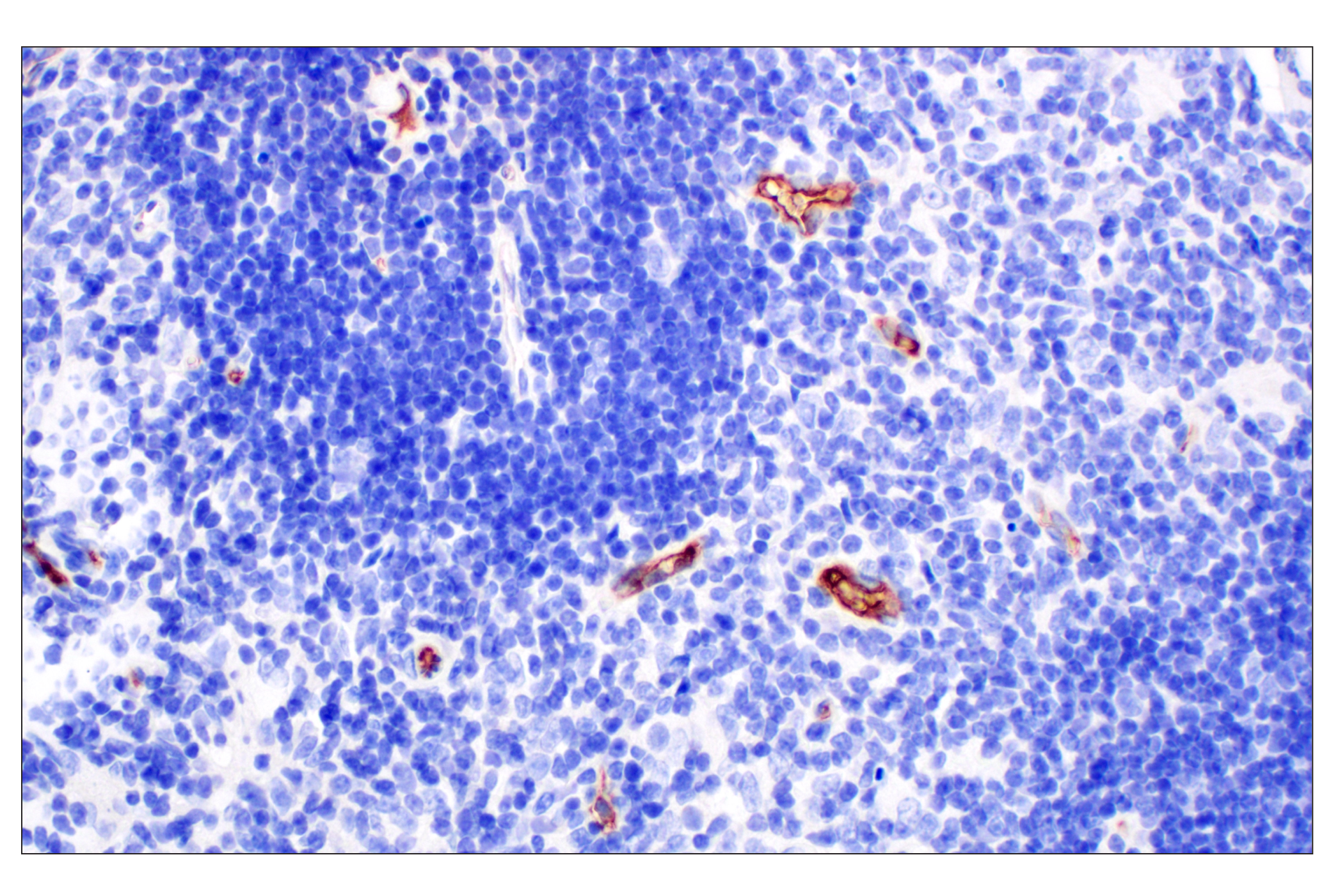 Immunohistochemistry Image 3: PNPLA3 (E7N6O) Rabbit mAb (BSA and Azide Free)
