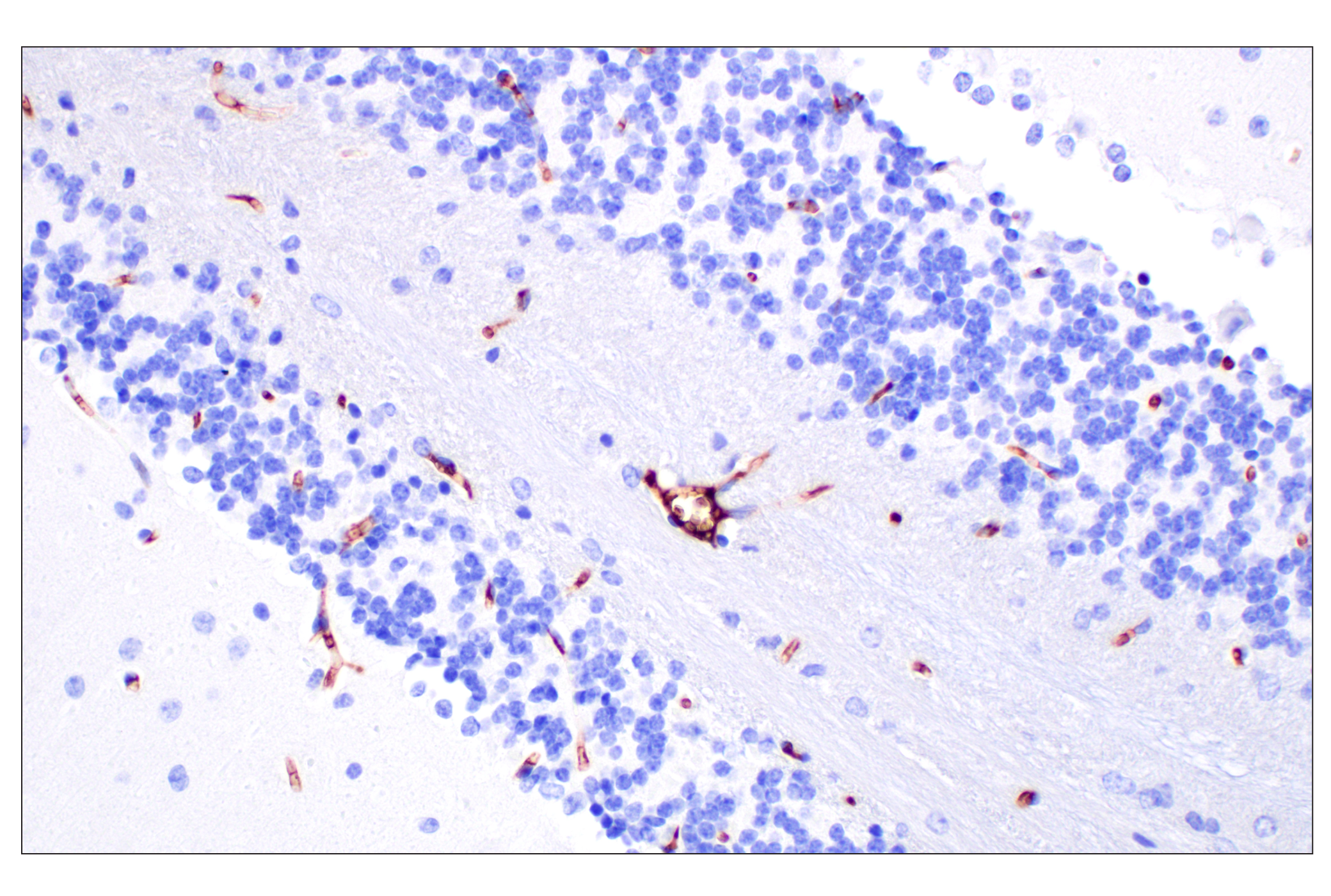 Immunohistochemistry Image 4: PNPLA3 (E7N6O) Rabbit mAb (BSA and Azide Free)