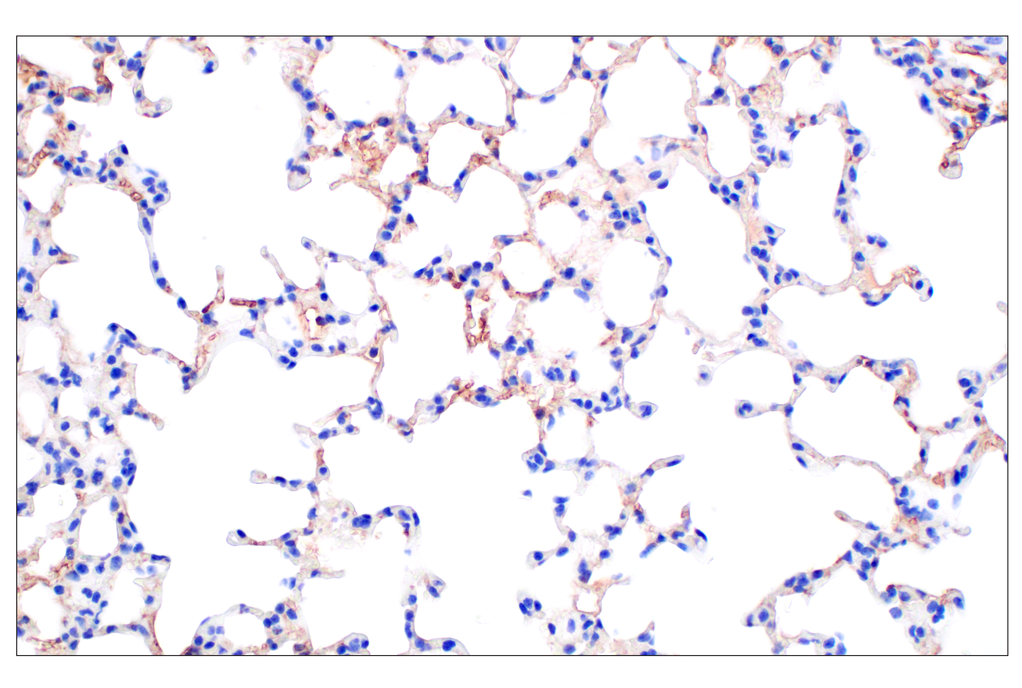 Immunohistochemistry Image 5: PNPLA3 (E7N6O) Rabbit mAb (BSA and Azide Free)