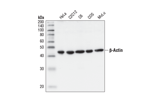 Western Blotting Image 1: β-Actin Antibody