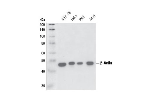 Western Blotting Image 2: β-Actin (13E5) Rabbit mAb