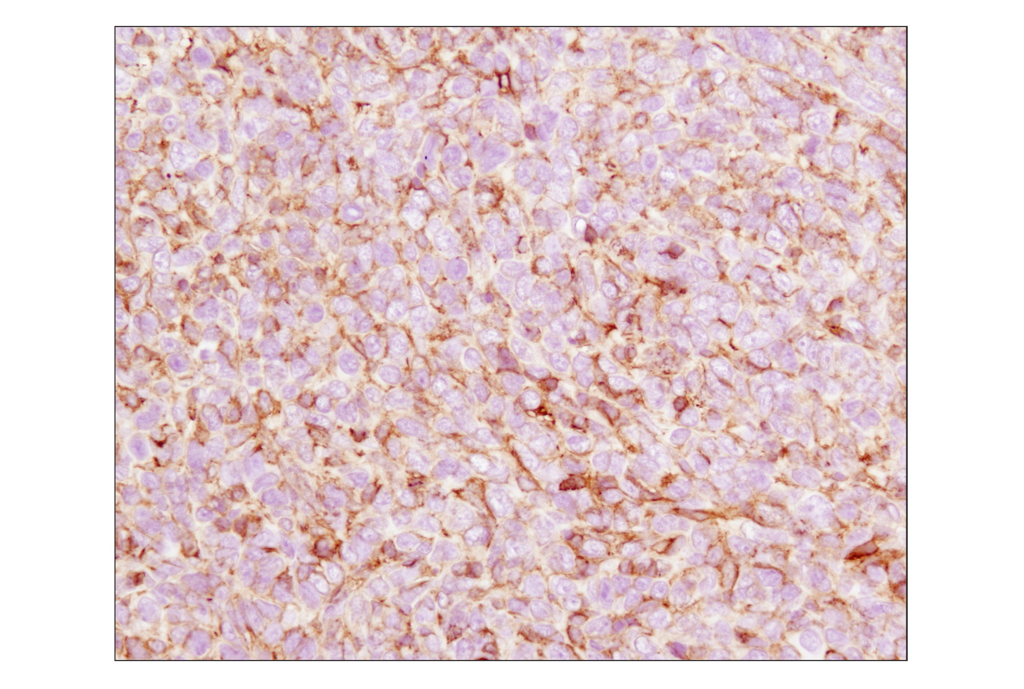 Immunohistochemistry Image 3: β-Actin (13E5) Rabbit mAb