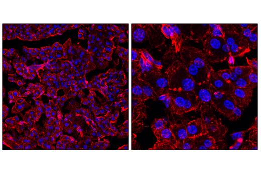 Immunofluorescence Image 1: β-Actin (13E5) Rabbit mAb (BSA and Azide Free)