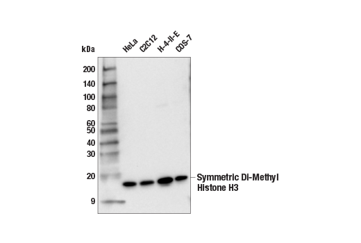 Western Blotting Image 1: Symmetric Di-Methyl Histone H3 (Arg2) (E8V5Q) Rabbit mAb
