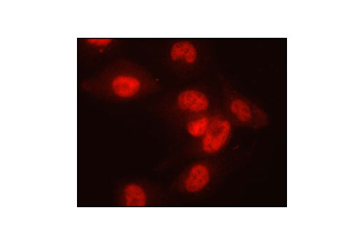 Immunofluorescence Image 1: SnoN Antibody