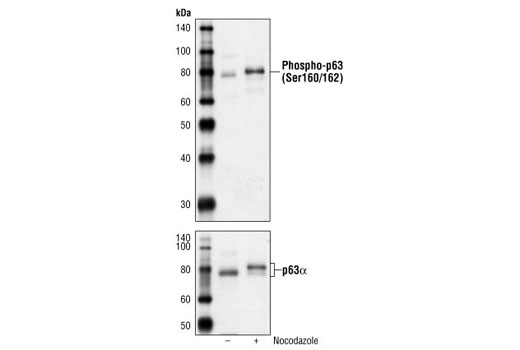Western Blotting Image 1: Phospho-p63 (Ser160/162) Antibody