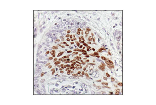Immunohistochemistry Image 1: Phospho-p63 (Ser160/162) Antibody