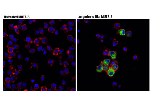 Immunofluorescence Image 1: Langerin (D9H7R) XP® Rabbit mAb (BSA and Azide Free)