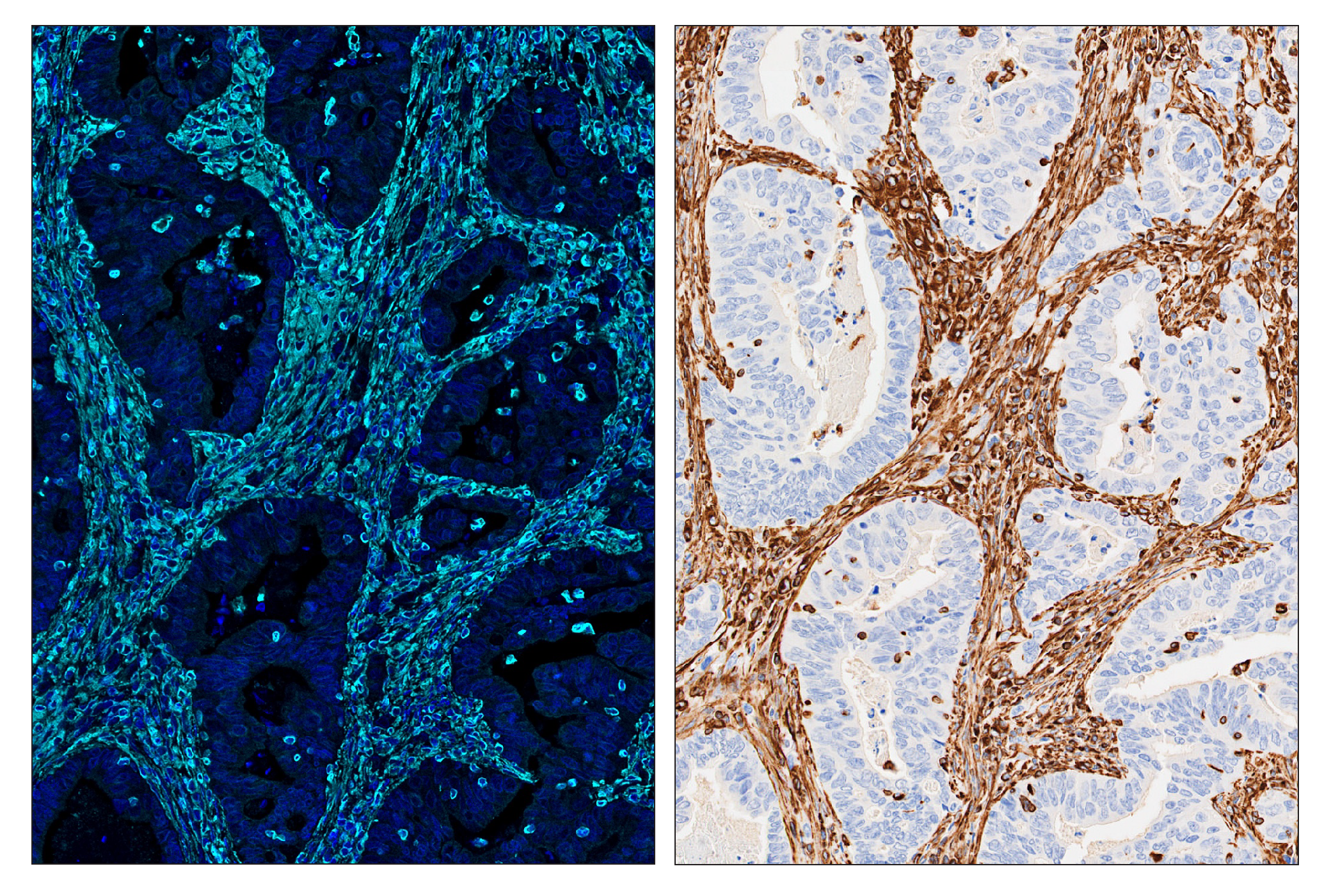 Immunohistochemistry Image 6: Vimentin (D21H3) & CO-0012-488 SignalStar™ Oligo-Antibody Pair
