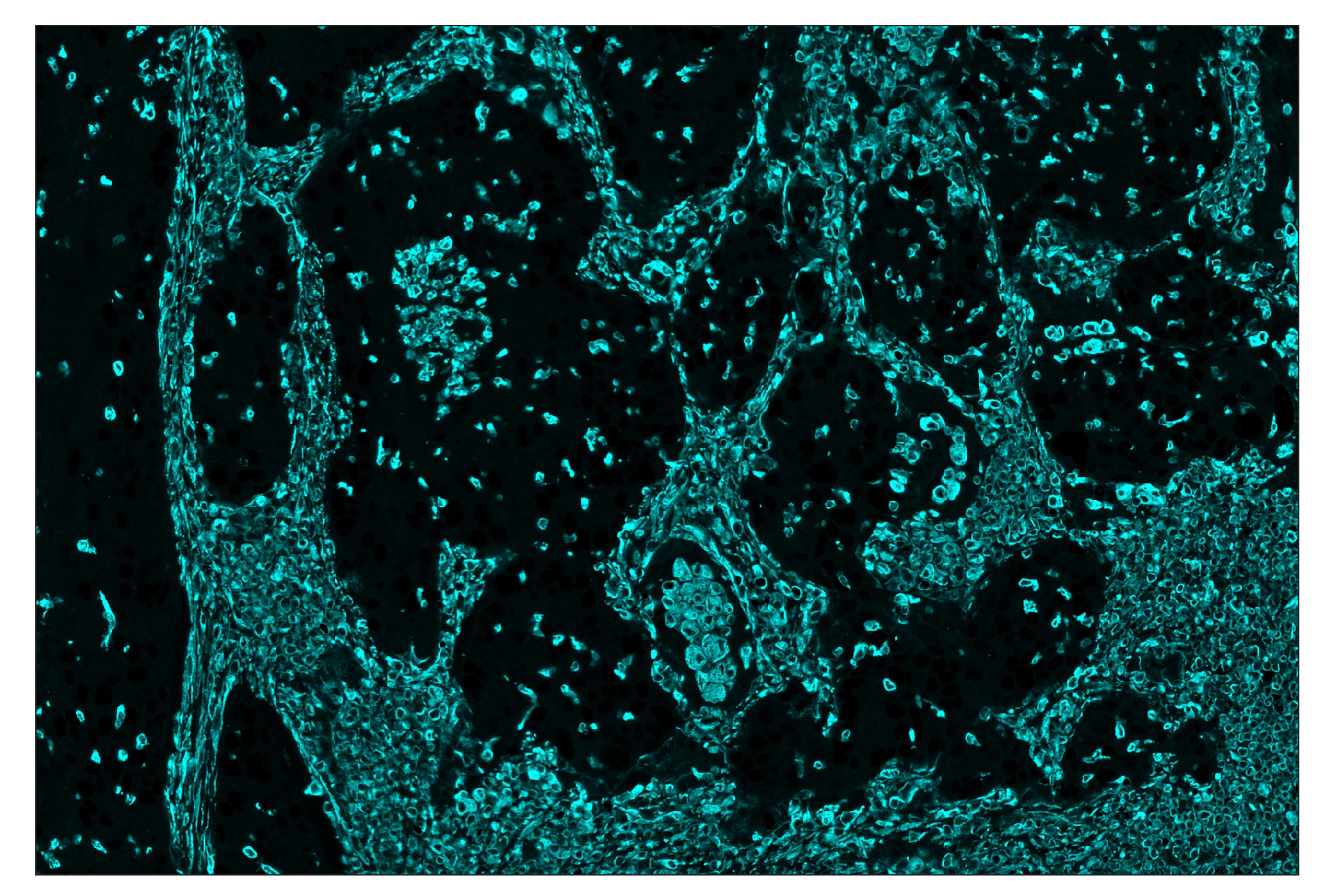 Immunohistochemistry Image 5: Vimentin (D21H3) & CO-0012-488 SignalStar™ Oligo-Antibody Pair