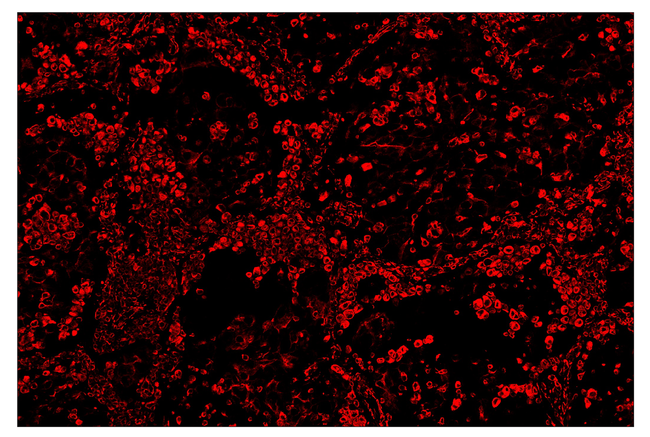Immunohistochemistry Image 4: Vimentin (D21H3) & CO-0012-750 SignalStar™ Oligo-Antibody Pair