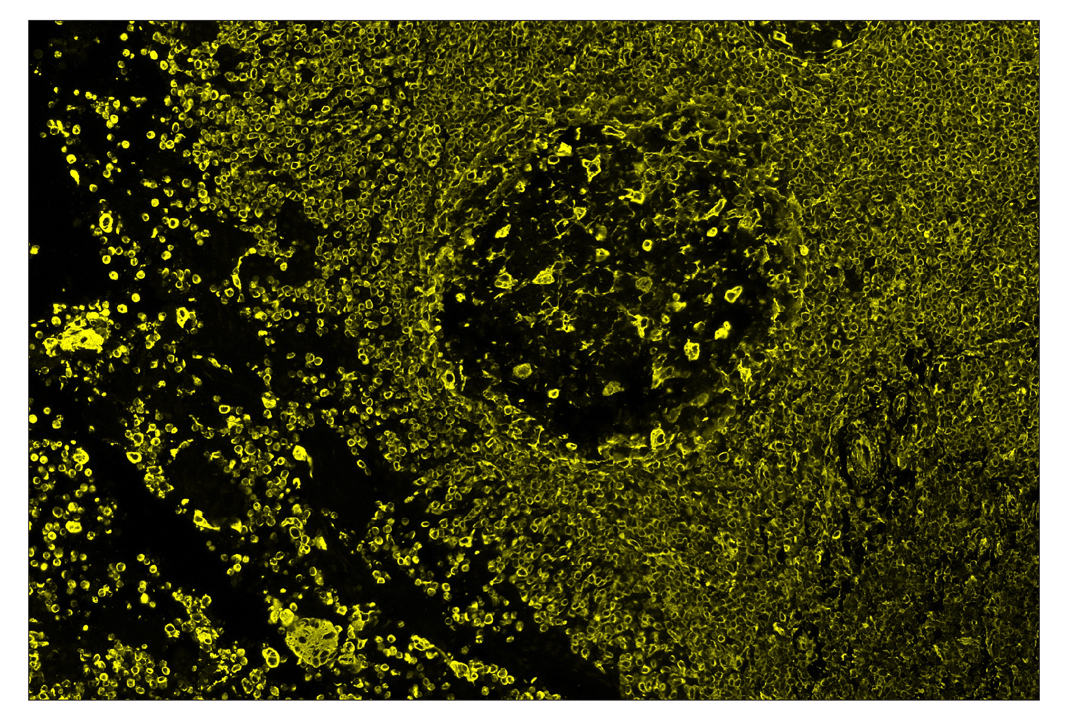 Immunohistochemistry Image 3: Vimentin (D21H3) & CO-0012-488 SignalStar™ Oligo-Antibody Pair