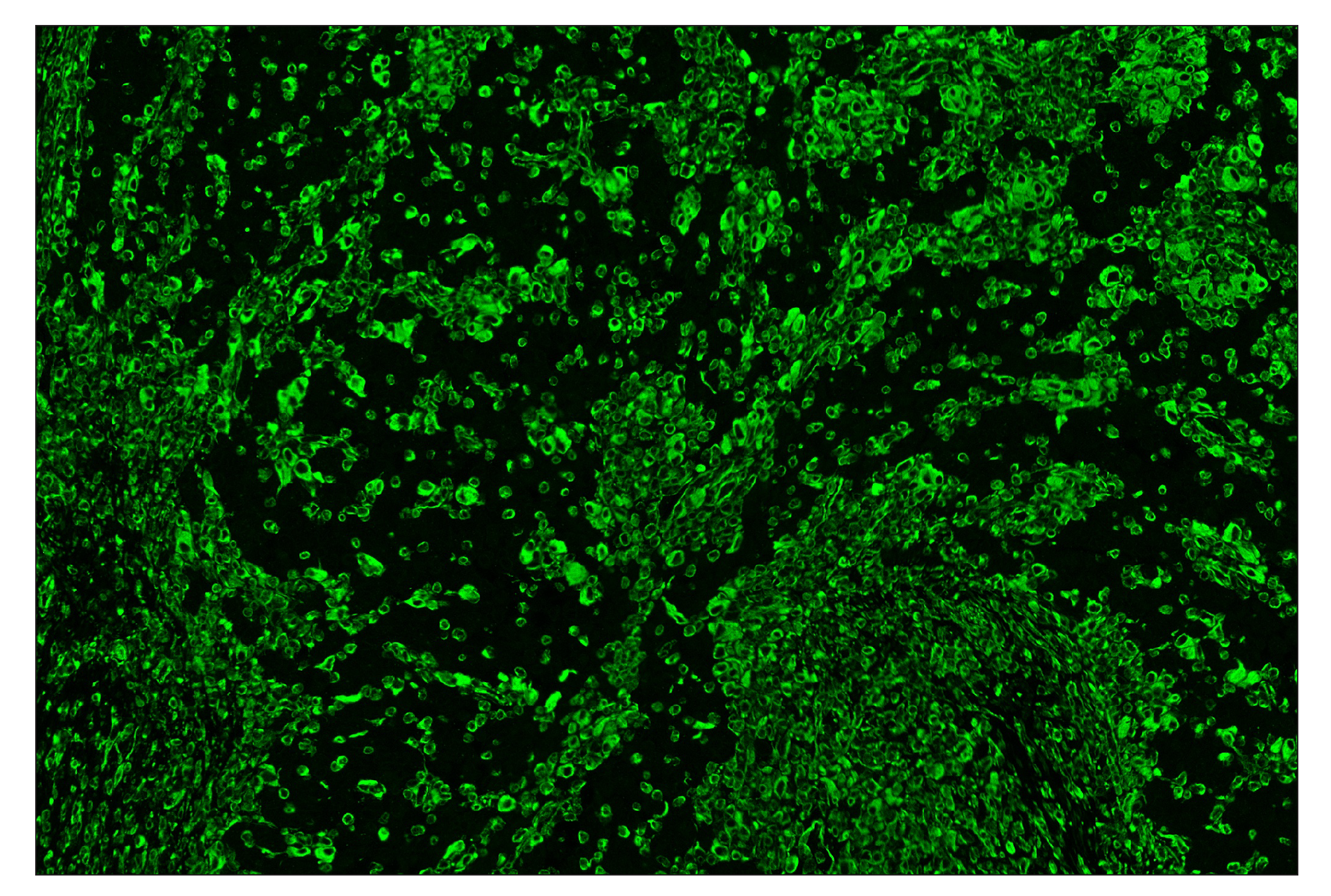 Immunohistochemistry Image 2: Vimentin (D21H3) & CO-0012-594 SignalStar™ Oligo-Antibody Pair