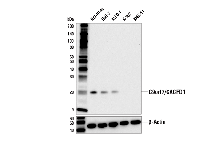 Western Blotting Image 1: C9orf7/CACFD1 Antibody