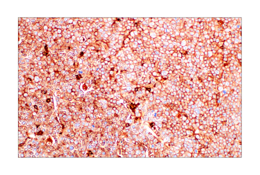 Immunohistochemistry Image 2: Integrin β2 (E9O7W) Rabbit mAb (BSA and Azide Free)