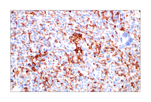 Immunohistochemistry Image 6: Integrin β2 (E9O7W) Rabbit mAb (BSA and Azide Free)
