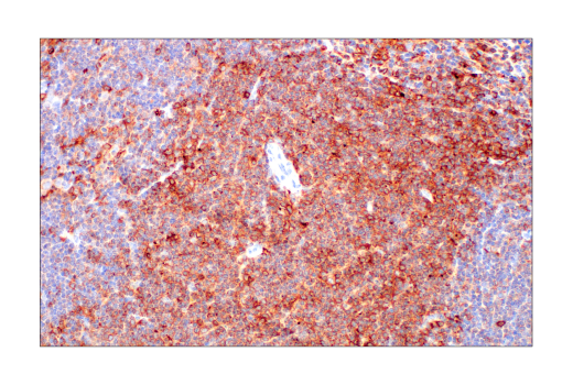 Immunohistochemistry Image 7: Integrin β2 (E9O7W) Rabbit mAb (BSA and Azide Free)