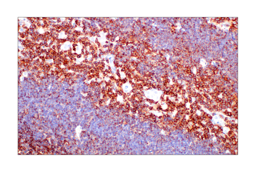 Immunohistochemistry Image 8: Integrin β2 (E9O7W) Rabbit mAb (BSA and Azide Free)