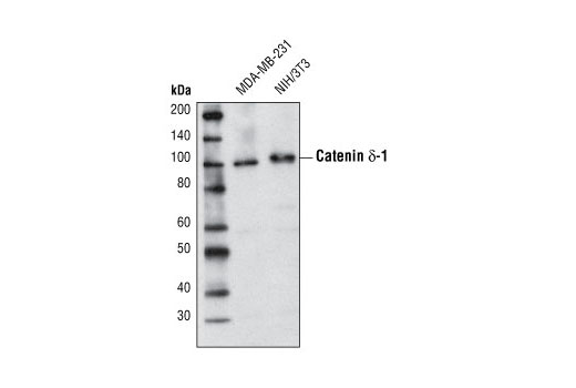 Western Blotting Image 1: Catenin δ-1 Antibody