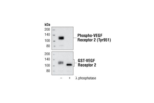  Image 4: Phospho-VEGF Receptor 2 Antibody Sampler Kit