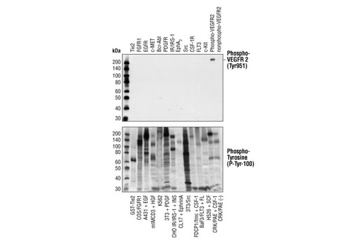  Image 7: Phospho-VEGF Receptor 2 Antibody Sampler Kit