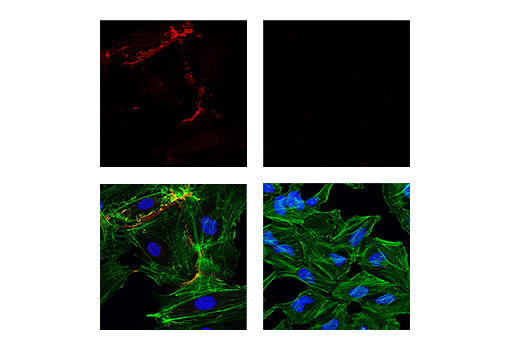 Immunofluorescence Image 1: CD31 (PECAM-1) (89C2) Mouse mAb (Alexa Fluor® 647 Conjugate)
