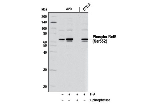 Western Blotting Image 1: Phospho-RelB (Ser552) Antibody
