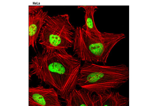 Immunofluorescence Image 1: JunD (D17G2) Rabbit mAb