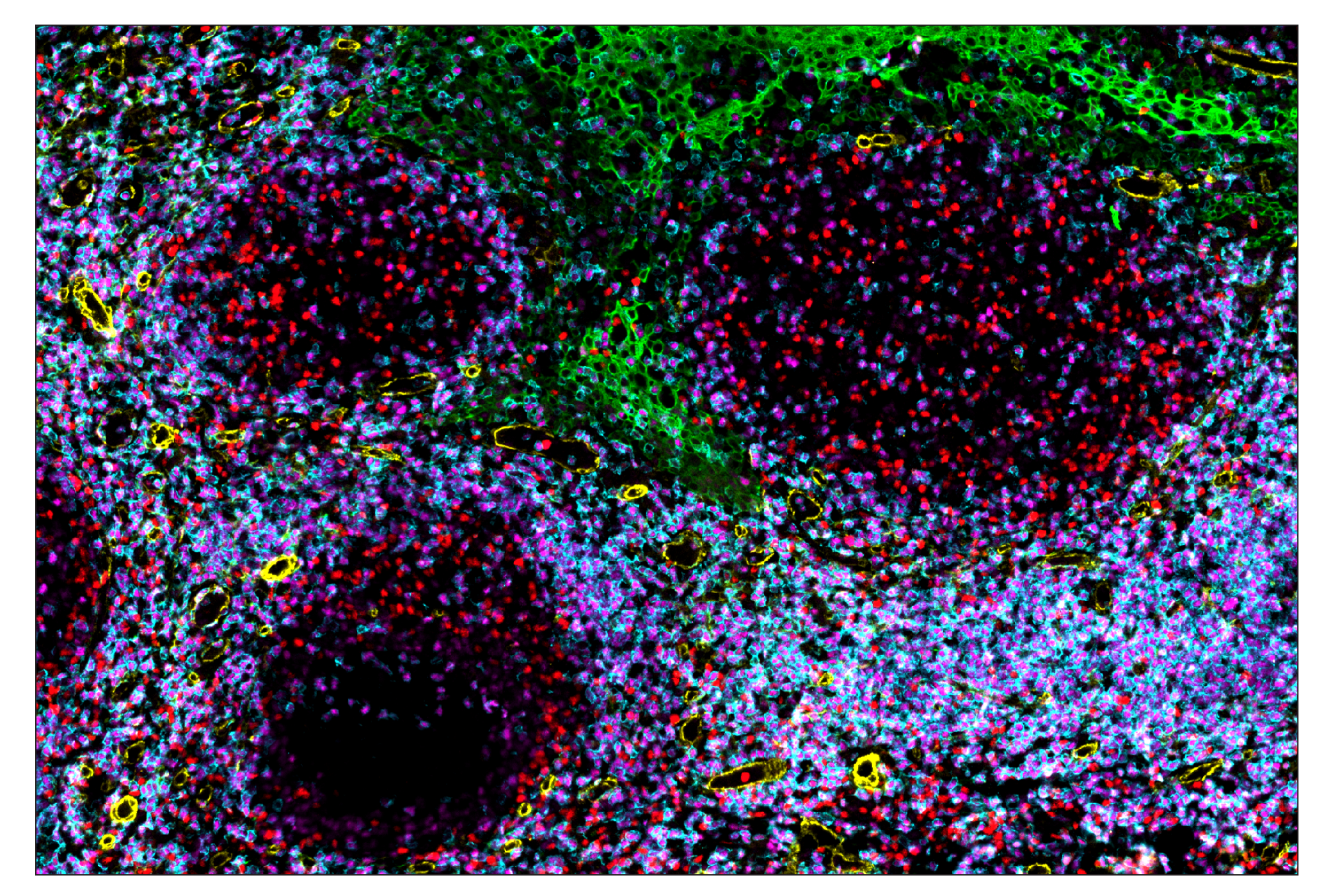 Immunohistochemistry Image 5: T-bet/TBX21 (E4I2K) & CO-0077-647 SignalStar™ Oligo-Antibody Pair