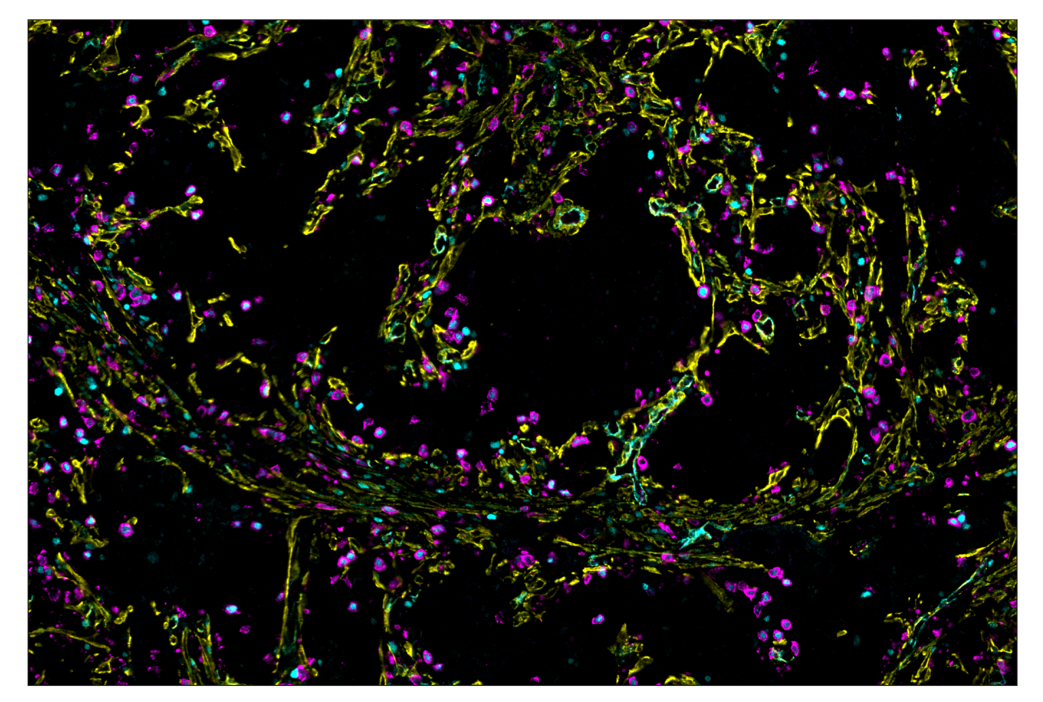 Immunohistochemistry Image 7: T-bet/TBX21 (E4I2K) & CO-0077-647 SignalStar™ Oligo-Antibody Pair