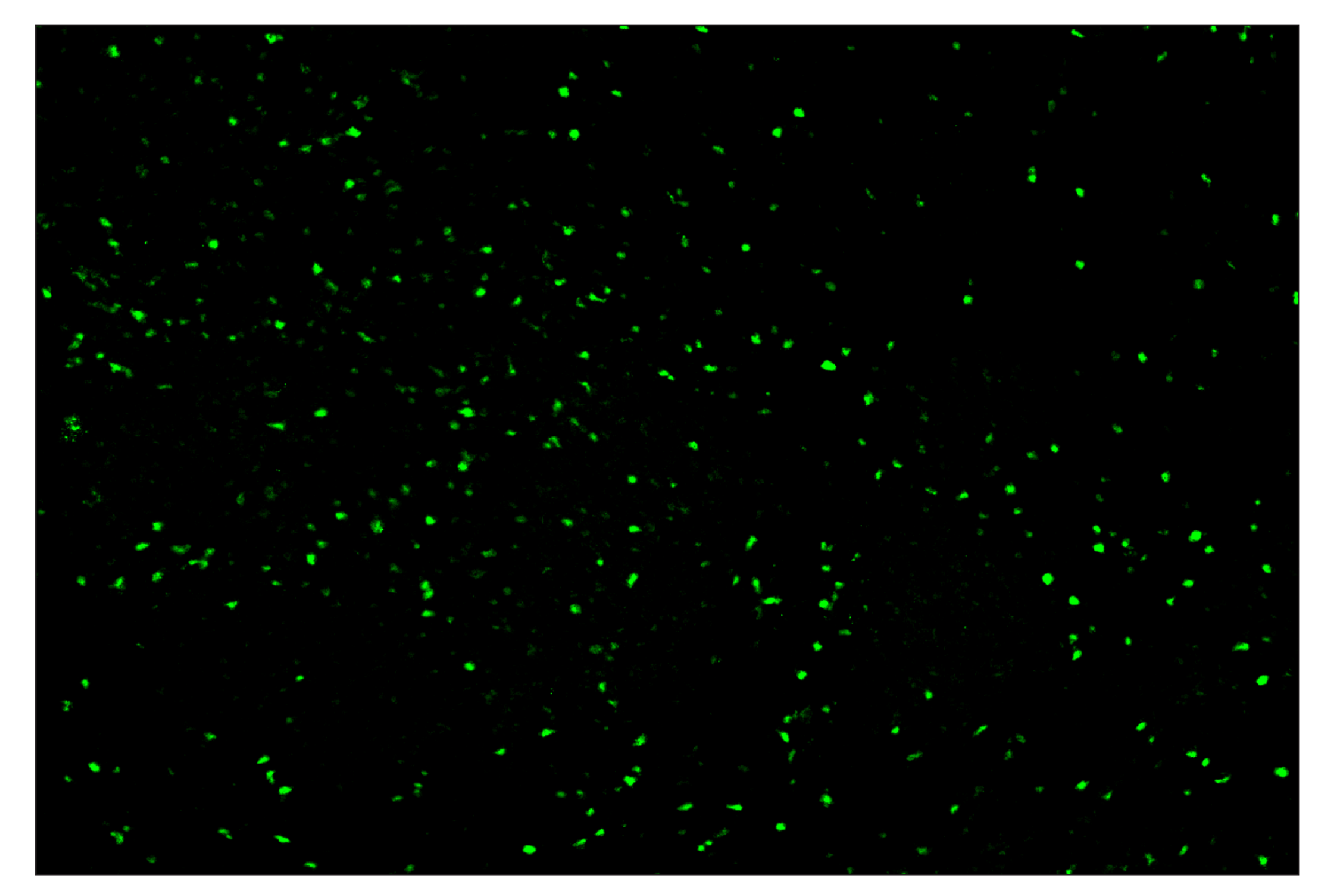 Immunohistochemistry Image 1: T-bet/TBX21 (E4I2K) & CO-0077-488 SignalStar™ Oligo-Antibody Pair