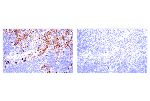 Immunohistochemistry Image 3: IL-2Rα/CD25 (E4B2Z) XP® Rabbit mAb (BSA and Azide Free)