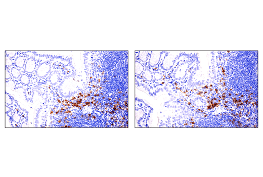 Immunohistochemistry Image 4: IL-2Rα/CD25 (E4B2Z) XP® Rabbit mAb (BSA and Azide Free)