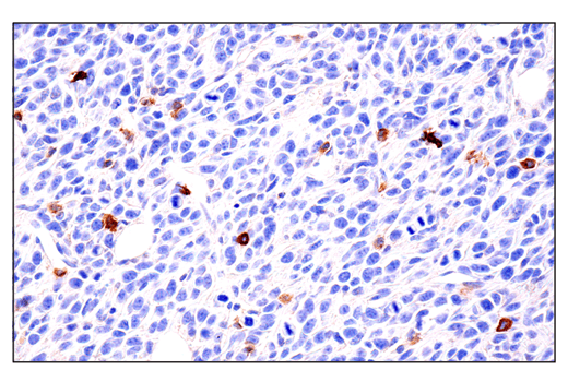 Immunohistochemistry Image 5: IL-2Rα/CD25 (E4B2Z) XP® Rabbit mAb (BSA and Azide Free)