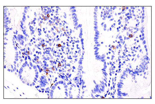 Immunohistochemistry Image 7: IL-2Rα/CD25 (E4B2Z) XP® Rabbit mAb (BSA and Azide Free)