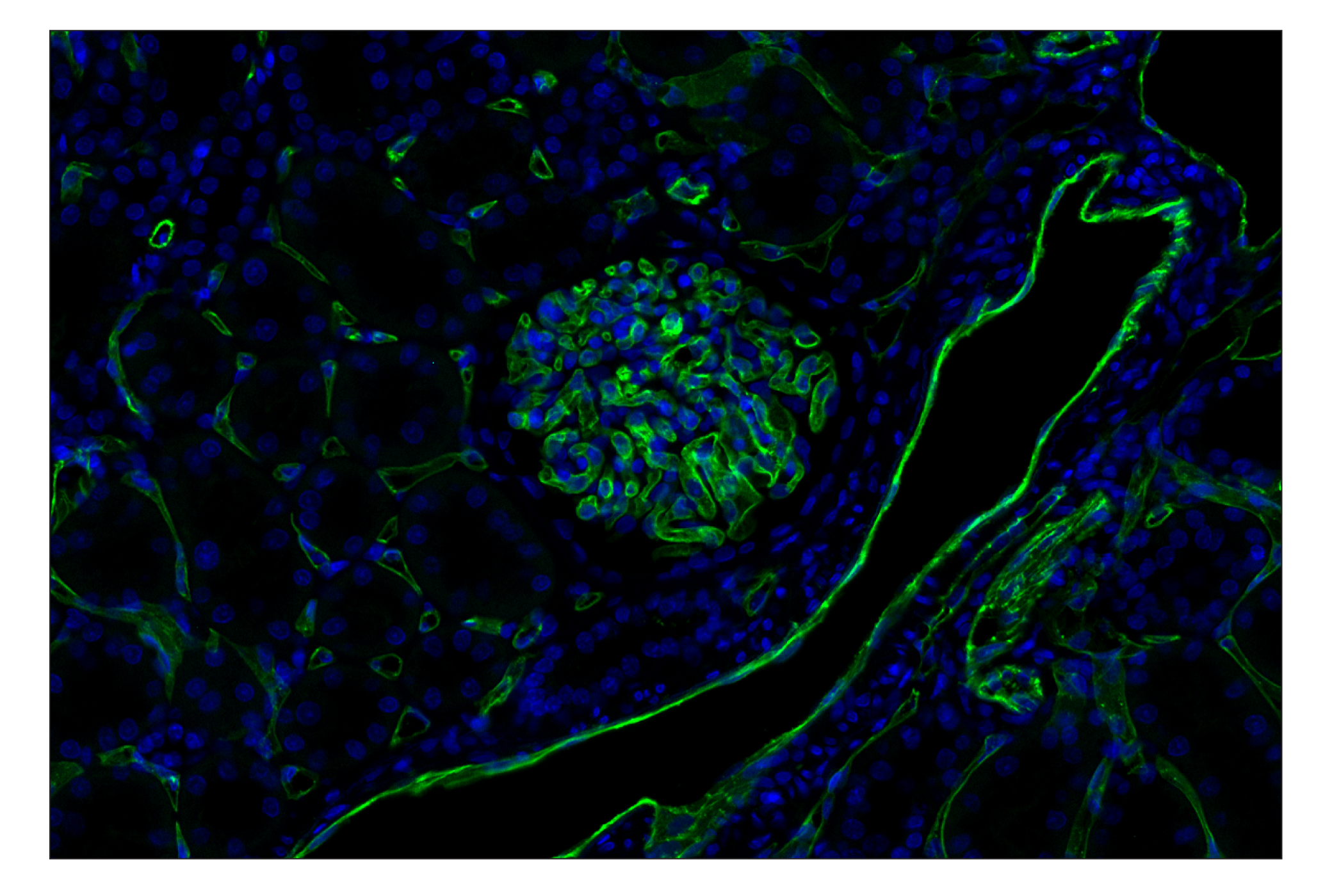 CD31 (PECAM-1) (F8M3S) Rabbit Monoclonal Antibody (Alexa Fluor