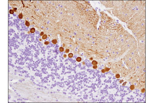 Immunohistochemistry Image 1: CaMKII-α (6G9) Mouse mAb