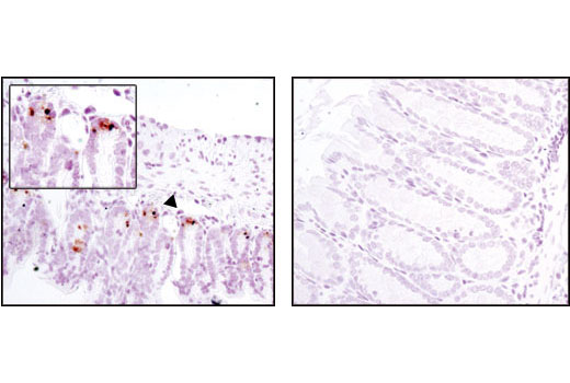 Immunohistochemistry Image 1: MMP-7 (D4H5) XP® Rabbit mAb (BSA and Azide Free)