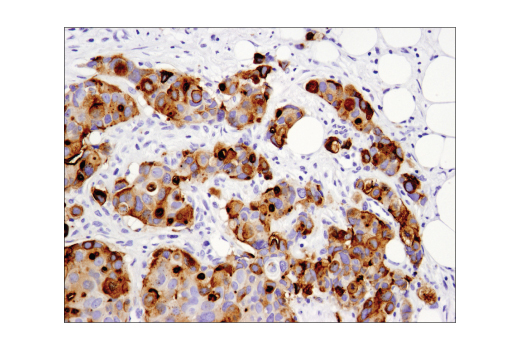 Immunohistochemistry Image 1: MUC1-C (D5K9I) XP® Rabbit mAb (BSA and Azide Free)