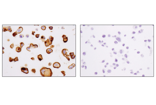 Immunohistochemistry Image 2: MUC1-C (D5K9I) XP® Rabbit mAb (BSA and Azide Free)