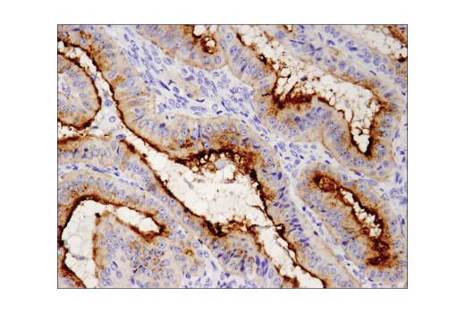 Immunohistochemistry Image 5: MUC1-C (D5K9I) XP® Rabbit mAb (BSA and Azide Free)