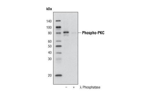 Western Blotting Image 1: Phospho-PKC (pan) (ζ Thr410) (190D10) Rabbit mAb (Biotinylated)