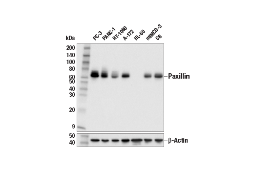 Western Blotting Image 1: Paxillin (E6R6Z) Rabbit mAb