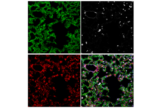 Immunofluorescence Image 1: Paxillin (E6R6Z) Rabbit mAb
