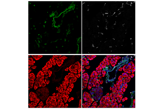 Immunofluorescence Image 2: Paxillin (E6R6Z) Rabbit mAb