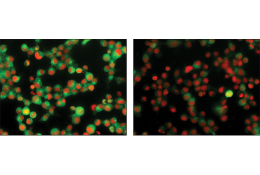 Immunofluorescence Image 1: Phospho-RelB (Ser552) (D41B9) XP® Rabbit mAb (BSA and Azide Free)